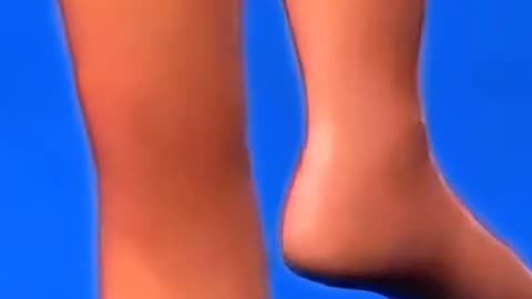 Rotationplasty Surgery Rare Limb-Saving Procedure Explained