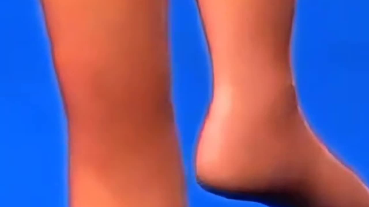 Rotationplasty Surgery Rare Limb-Saving Procedure Explained