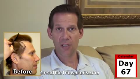 Dr. Brett Bolton – Follow a World-Renowned Hair Transplant Consultant Through His Own Procedure