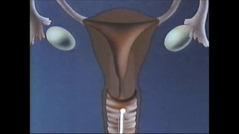 Intrauterine Devices (International Planned Parenthood Federation, 1989) (1989)
