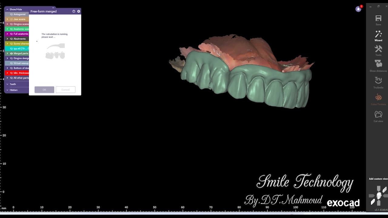 #design #naildesign #dental #dentaldesign #exocadexpert