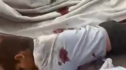 Israel starves people. Then kills them when they go to get food.