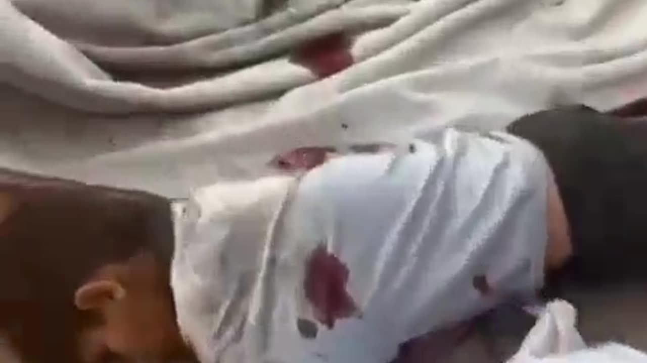 Israel starves people. Then kills them when they go to get food.