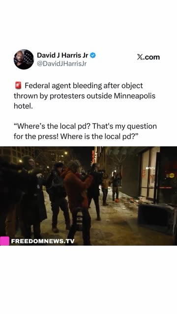 Politics - 2026 MN Federal Agent Bleeding Yelling Where The Fuck Is The Local PD Cops Commie Fucks