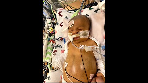 Dr. Larry Palevsky, renowned pediatrician alarmed on a critical issues!