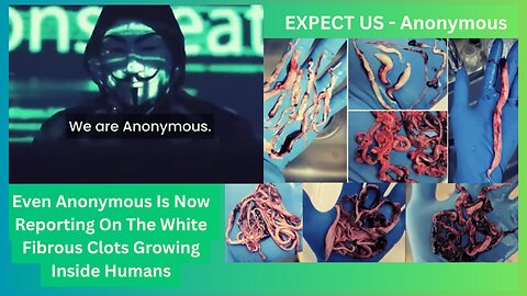Even Anonymous Is Now Reporting On The White Fibrous Clots Growing Inside Humans