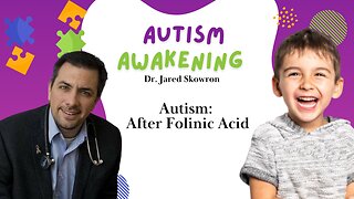 Autism: After Folinic Acid
