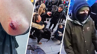 RAW: Masked thug attack Rebel News requiring stitches, Mtl Antifa tries to stop us from reporting