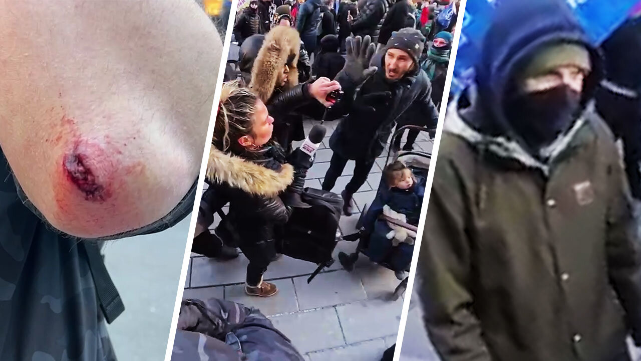 RAW: Masked thug attack Rebel News requiring stitches, Mtl Antifa tries to stop us from reporting