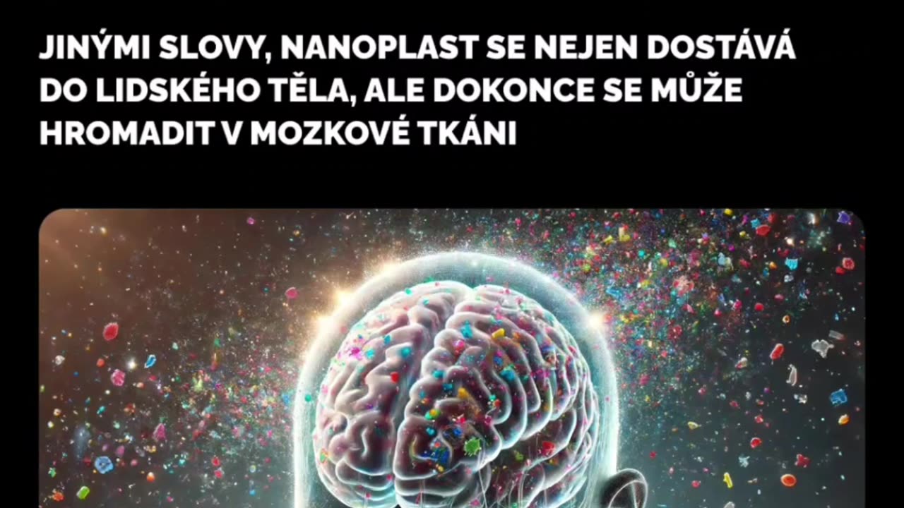Vedci zistili príčinu autizmu u detí