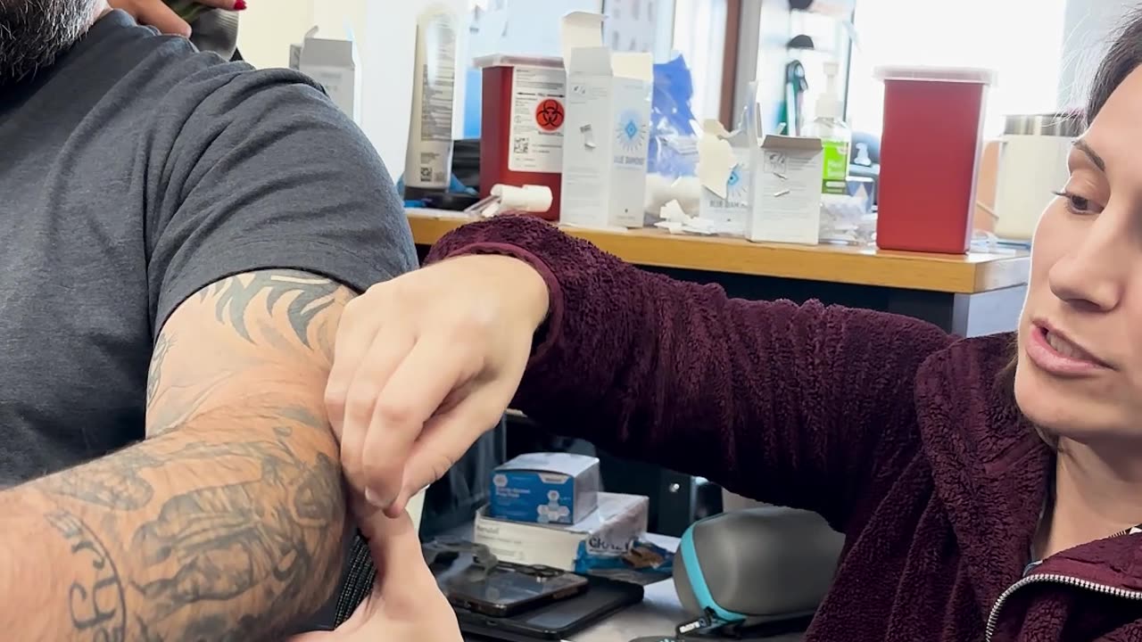 How to Fix Elbow Pain from Weight Lifting with Dry Needling?