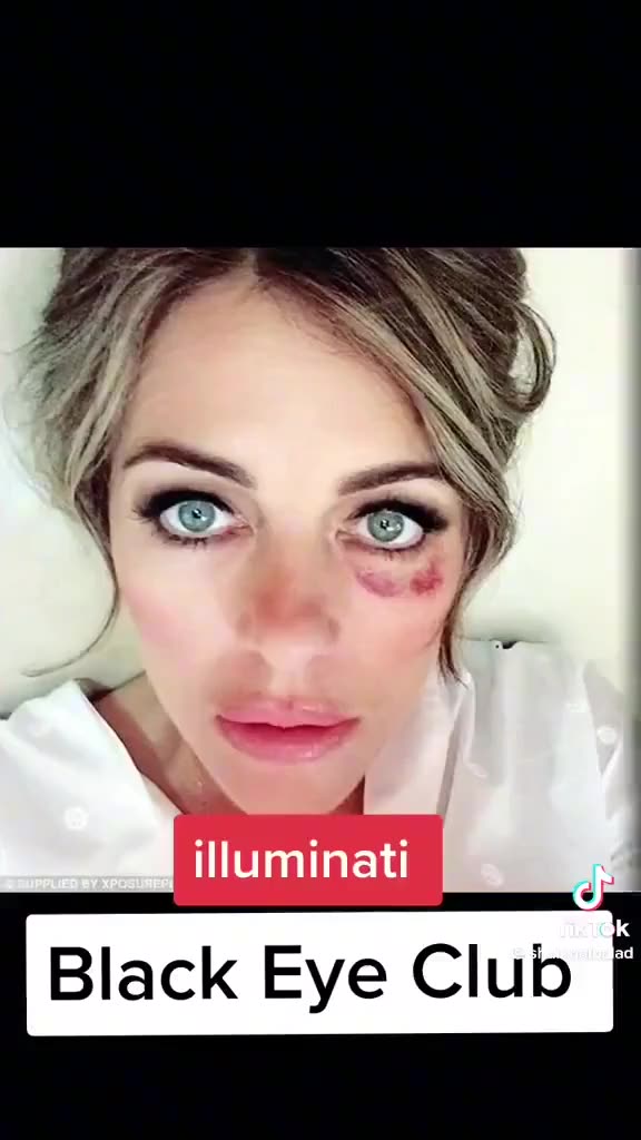 The Black Eye Club