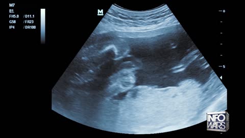 Satanic Abortion Destruction Rituals Institutionalized In The USA