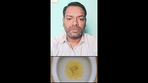 पेशाब में प्रोटीन आने के लक्षण ।