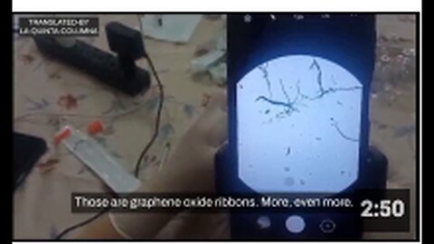 "2012 Batch of Levobupivacaine With 2017 Expiration Date Contaminated With Graphene"
