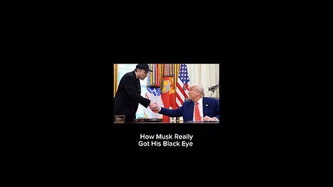 How Elon Musk Really Got His Black Eye