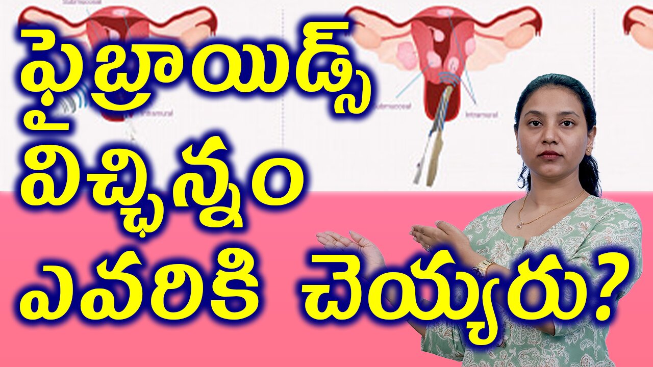 ఫైబ్రాయిడ్స్ విచ్ఛిన్నం ఎవరికి చెయ్యరు? Painless Faibroids Removal Surgery Laser Myolysis Warnings