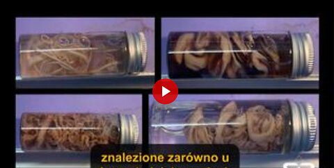 Szczepienia powodujące skrzepy – złowieszcza nauka stojąca za tym zjawiskiem