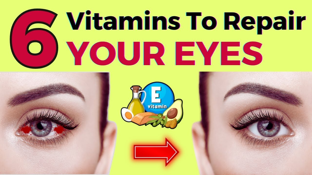 Best 6 Vitamins For Your EYE HEALTH - Restore and Heal Your Eyes | VJ06