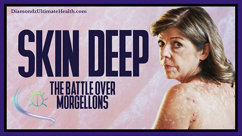 🎬🪱 Documentary: 'Skin Deep: The Battle Over Morgellons' A Controversial Condition Marked by Skin Lesions, Itching, and Mysterious Fibers