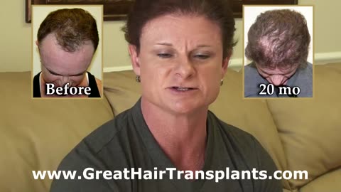 Dr. Brett Bolton Delivers an Incredible Female Hair Transplant Transformation