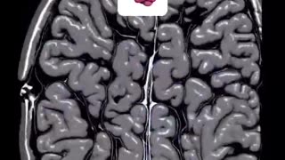 Reset your brain
