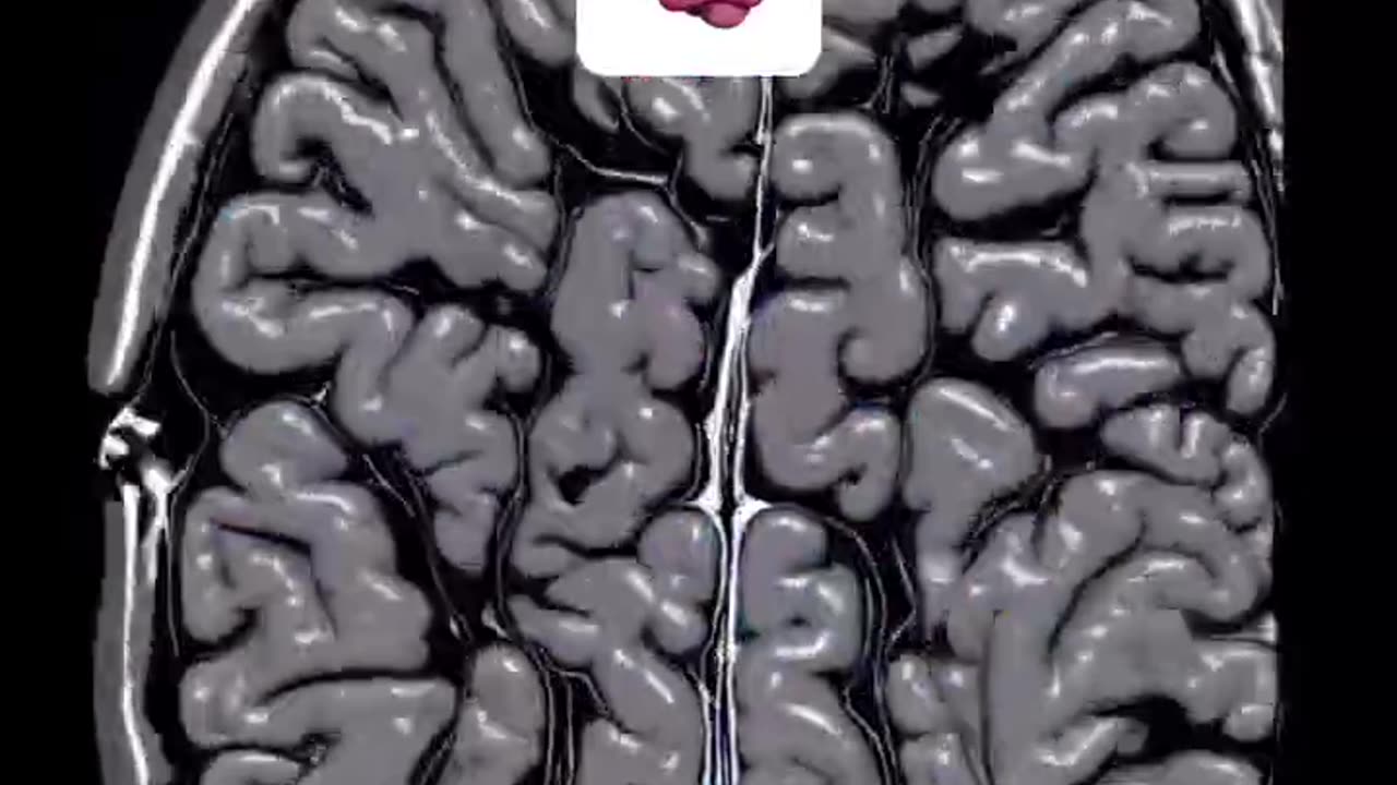 Reset your brain