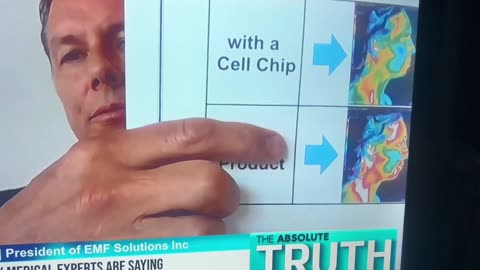 Is 5 G frying our brains like they were in a microwave oven?