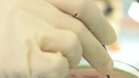Kidney Transplantation | Expert Kidney Problem Doctor in Madurai
