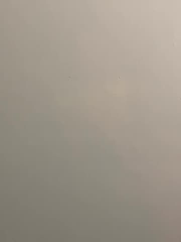 Pins and needles in my feet!!!!