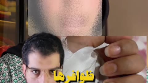 هل فعلاً الأظافر الصناعية بتسبب السرطان؟ الحقائق كاملة | الساينتست - El Scientist