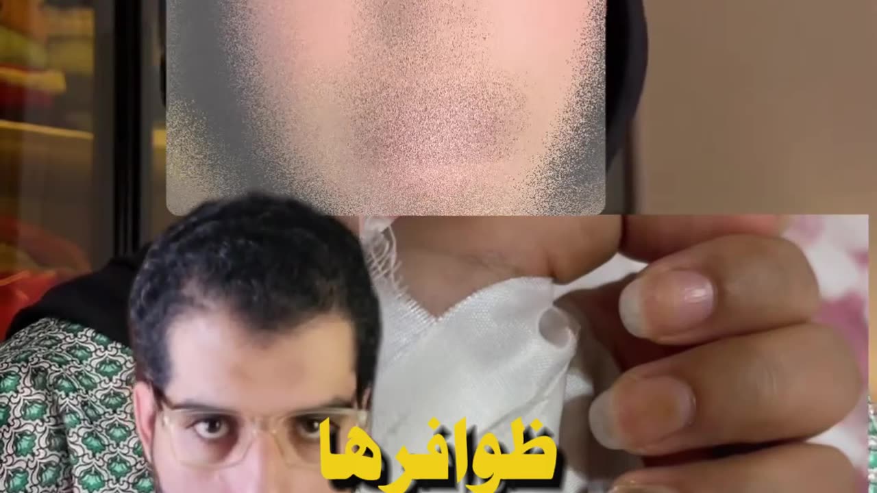 هل فعلاً الأظافر الصناعية بتسبب السرطان؟ الحقائق كاملة | الساينتست - El Scientist