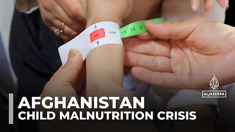 Afghan children face alarming malnutrition as aid cuts and crisis deepen