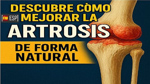 ES - Te Duele Moverte? Soluciones Naturales para Aliviar la Artrosis