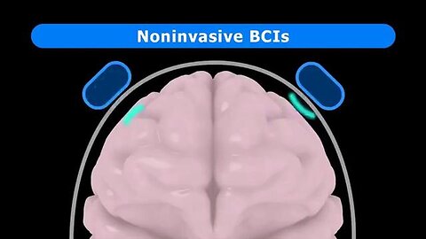 "Unlocking the Future: Cyborgs, Synthetic Biology & Growing Brain Implants"