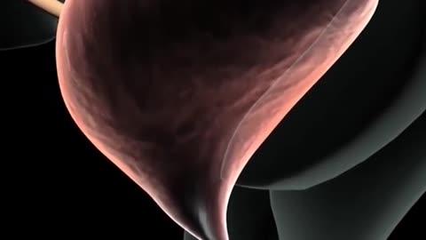 Cystoscopy Procedure 3D Animation