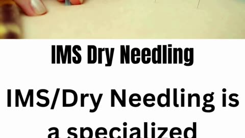 Relieve Chronic Pain with IMS / Dry Needling | Golden Maple Physiotherapy