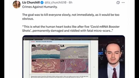 MRNA effect..