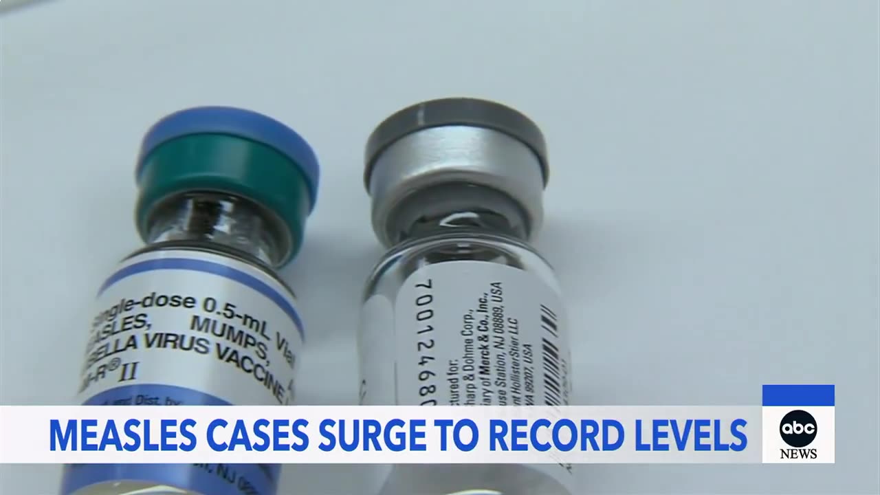 July 6, 2025 - Measles Cases Surge in USA
