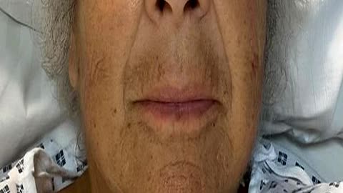 Miriam Margolyes Wants to Be Put Down If Health