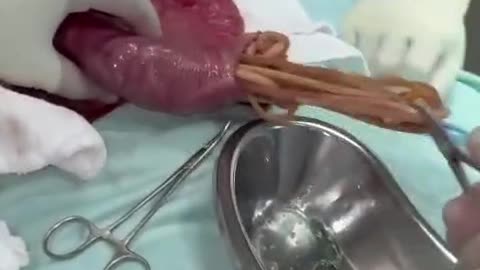 Parasites inside you