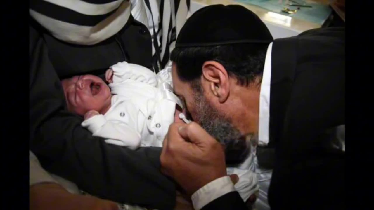 Jews Performing Metzitzah B'peh