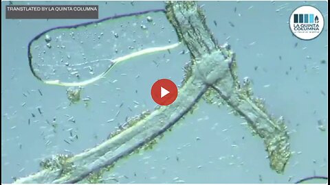 More GRAPHENE & WEIRD STRUCTURES Found In Multiple COV-ID + Calendar 'Vaccines' (La Quinta Columna)