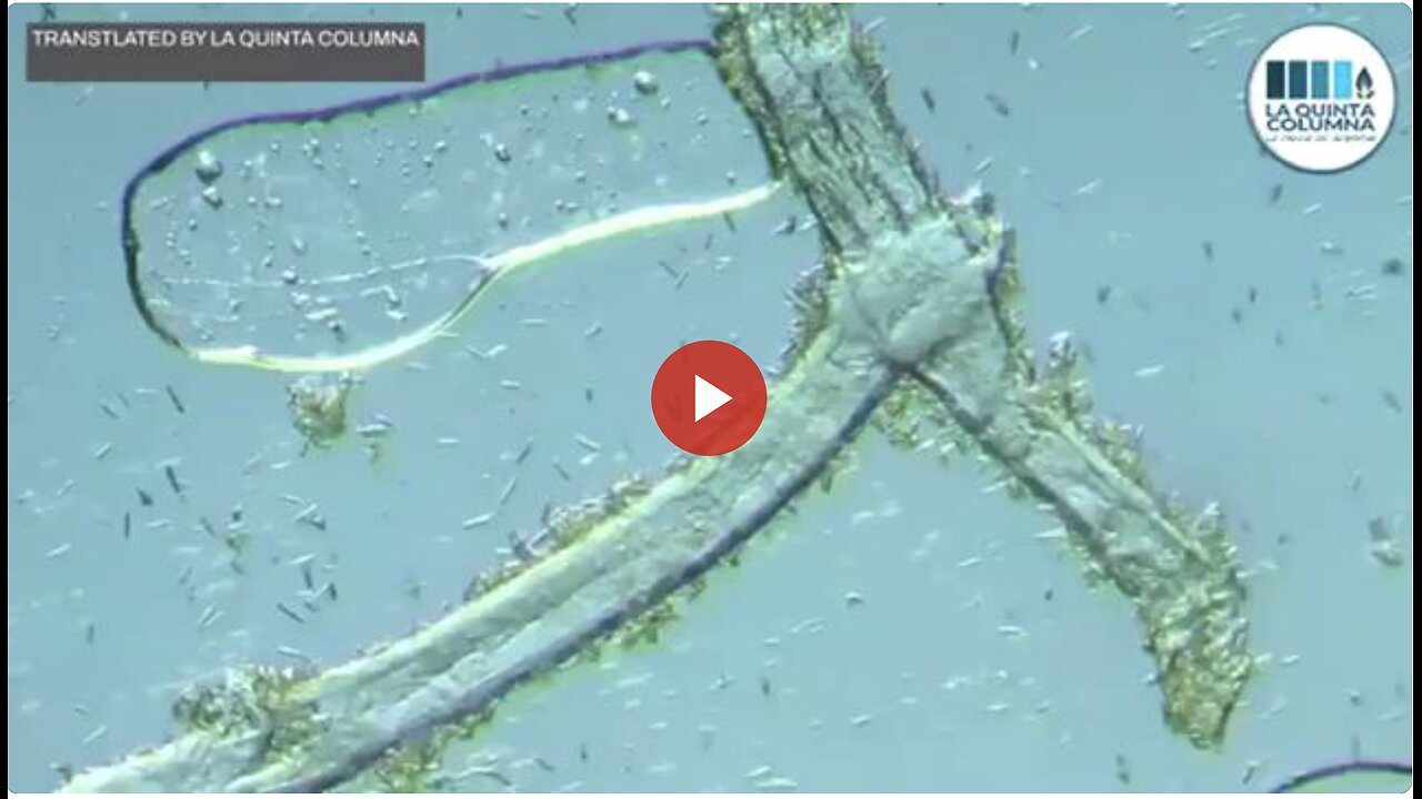More GRAPHENE & WEIRD STRUCTURES Found In Multiple COV-ID + Calendar 'Vaccines' (La Quinta Columna)