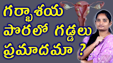 గర్భాశయ పొరలో గడ్డలు ప్రమాదమా Are Lumps In The Uterine Lining Dangerous? | Adinomayosis Homeopathy