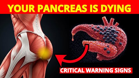 8 PANCREATIC CANCER Signs Doctors DON'T Tell You | Dr. William Reveals Hidden Symptoms