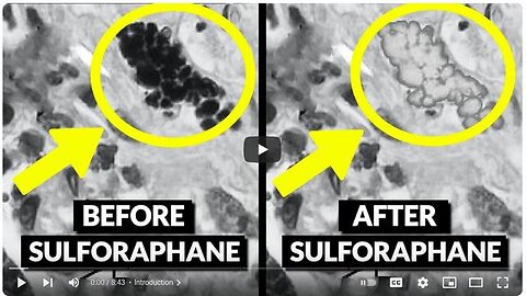 How To Detox Microplastics From Our Cells