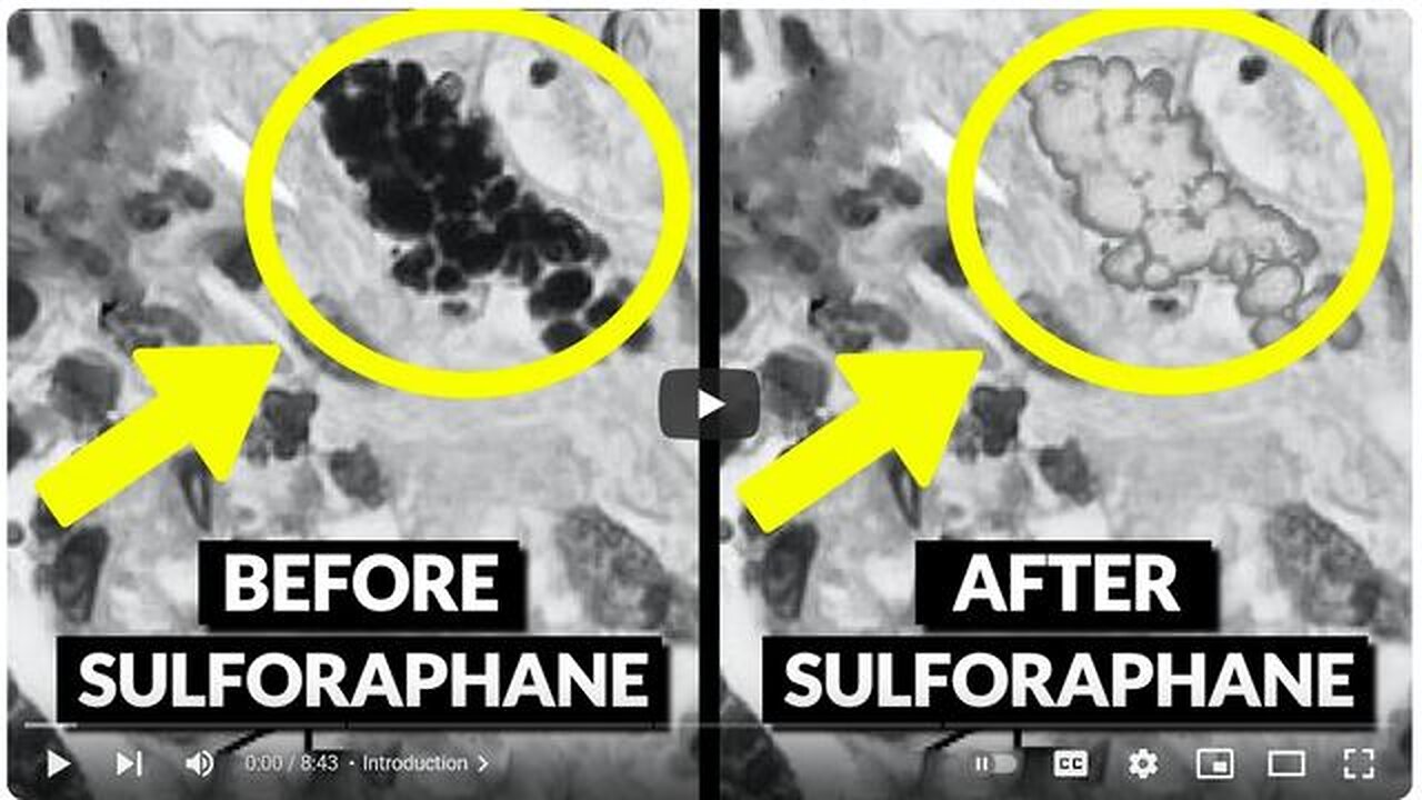 How To Detox Microplastics From Our Cells