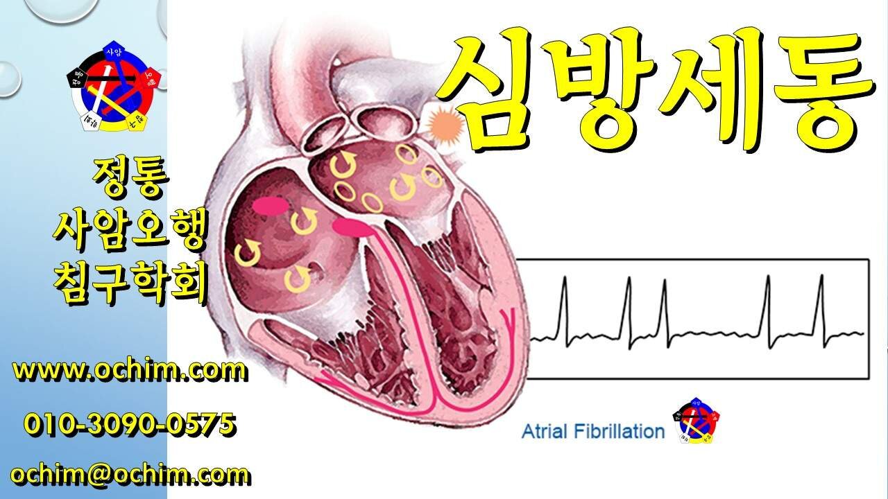 심방세동 치료 후기와 치료 방법 - 사암오행침, 사암침법, 오행침, 정통사암침