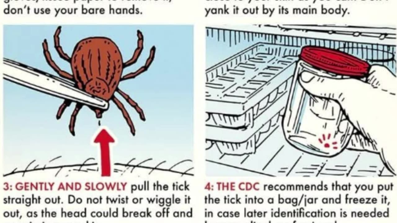 How to remove a tick 🔥💧🌲🍁🍂❄